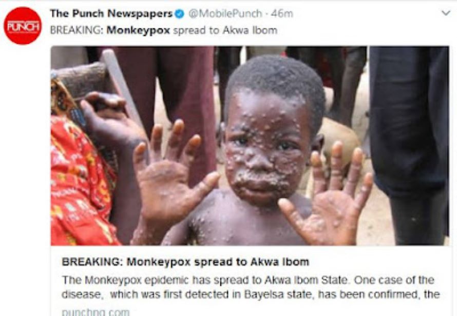 monkeybox disease to spread