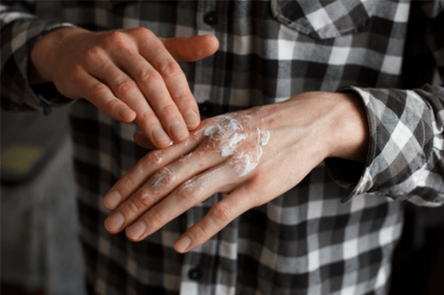 reduce itching and treat skin irritation