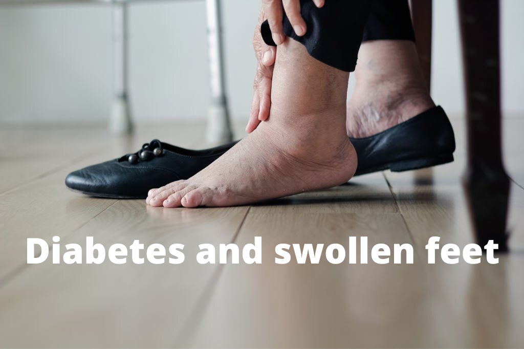 Reduce Risk For Diabetes And Swollen Feet Ultimate Guide Fitness