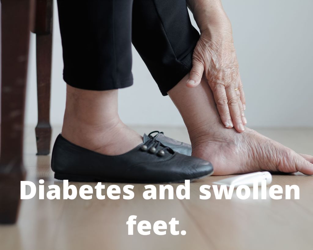 Reduce risk for Diabetes and swollen feet