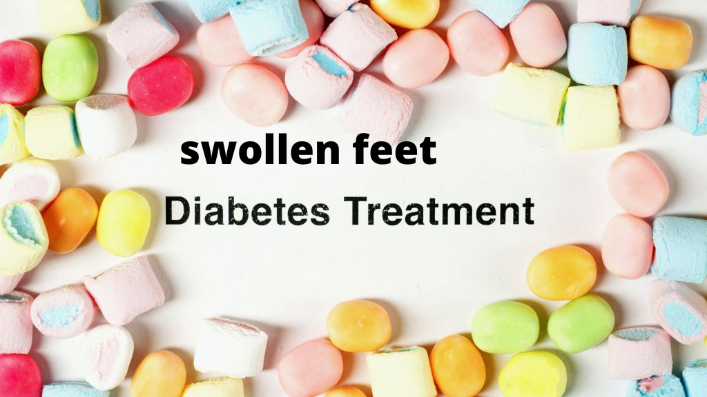 Treatment for Diabetes and swollen feet