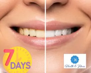 7 days, how can I whiten my teeth