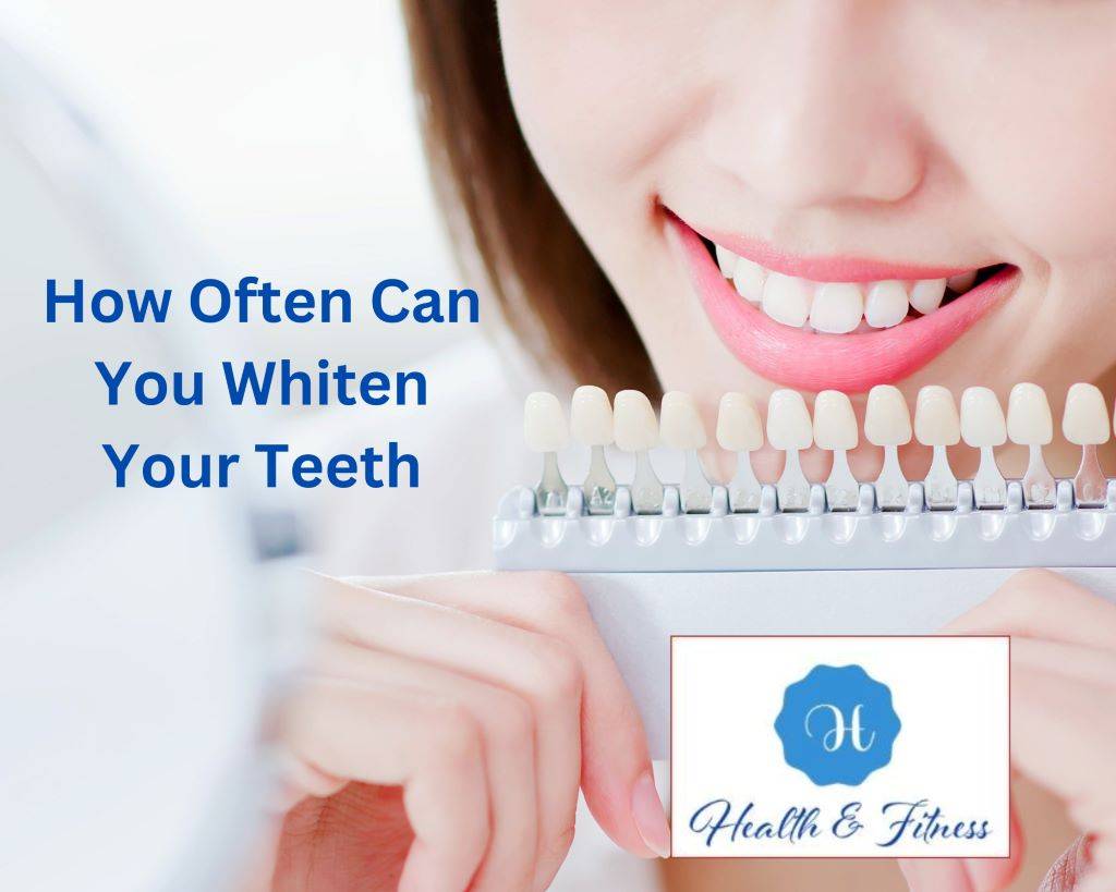 How Often Can You Whiten Your Teeth