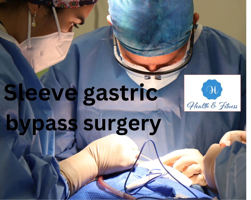 Sleeve gastric bypass surgery