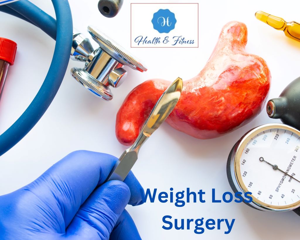 Weight loss surgery