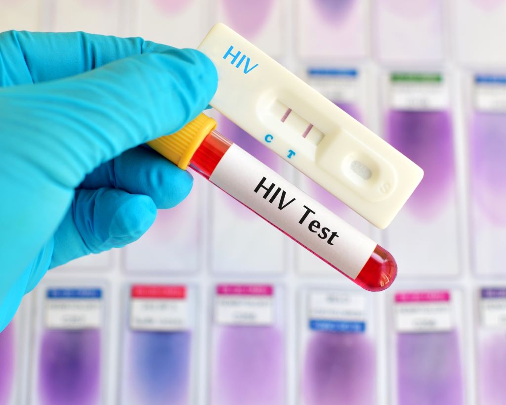 Health Screenings for HIV