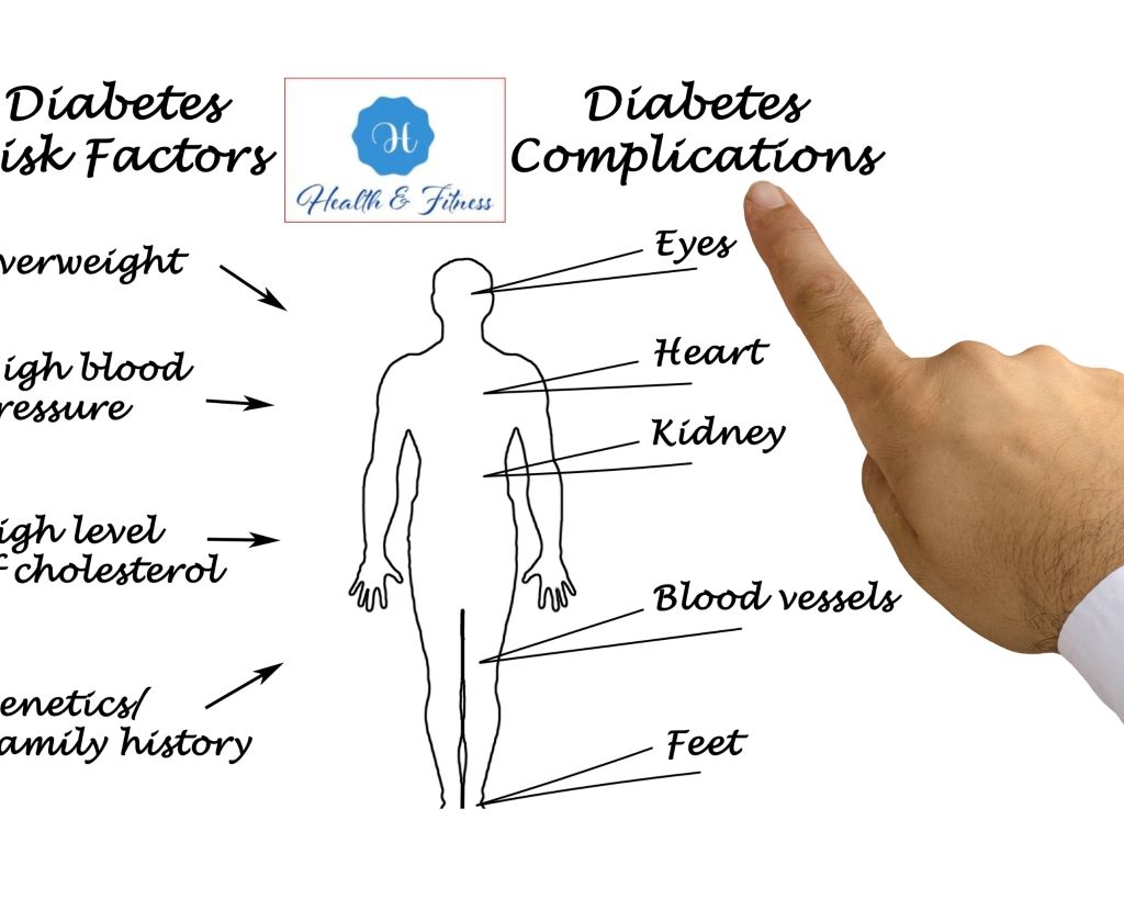 Prediabetes Complications