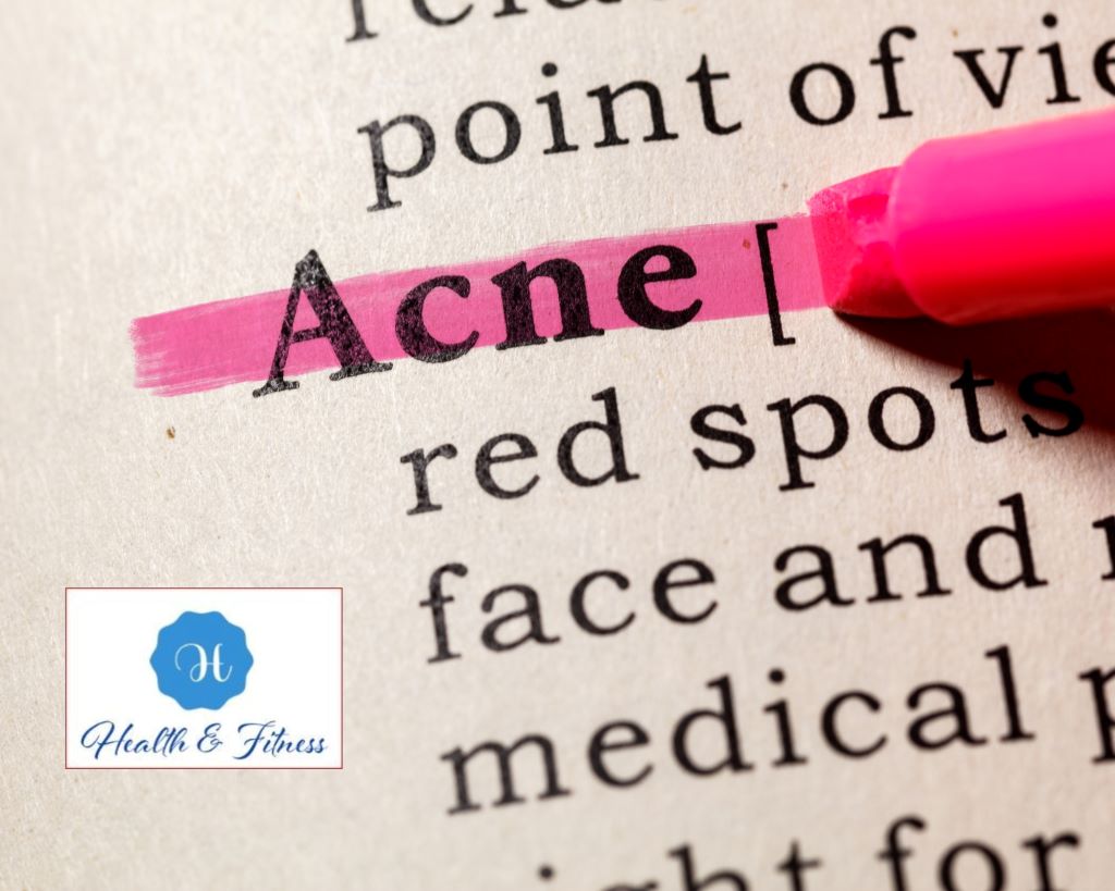 The Roots of Infant Acne or baby acne