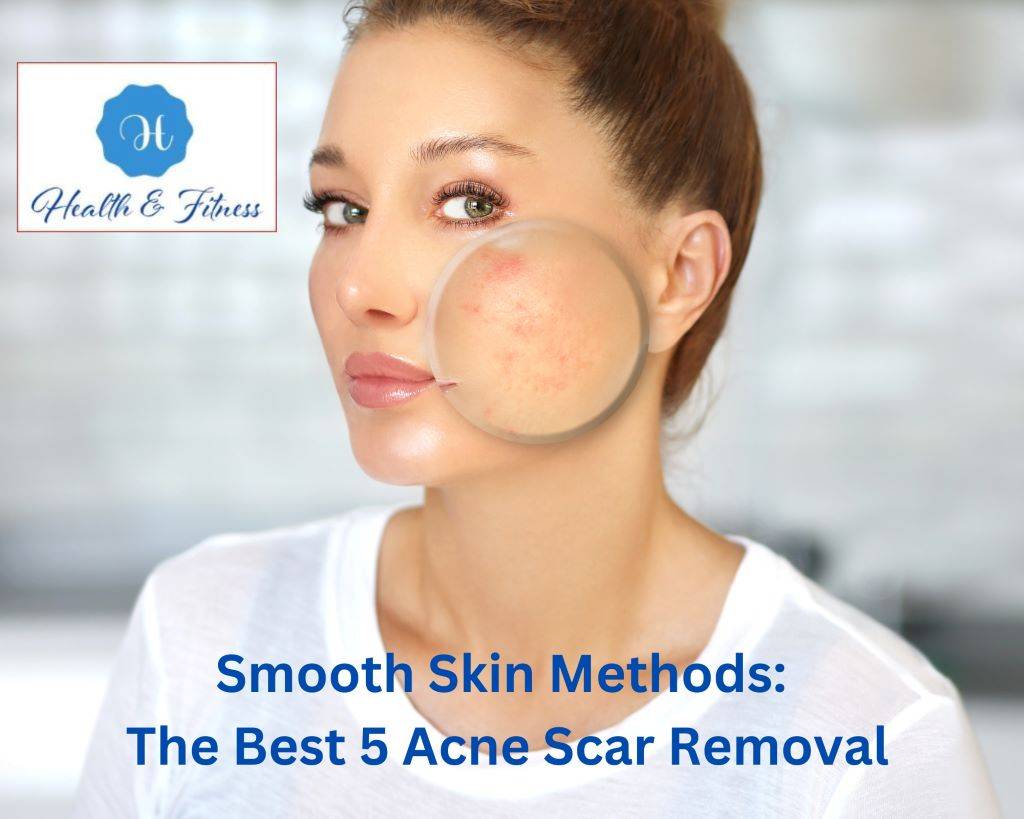 Smooth Skin Methods The Best 5 Acne Scar Removal