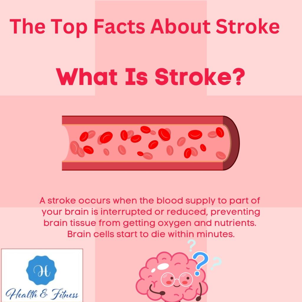 stroke facts stroke cdc centers for disease