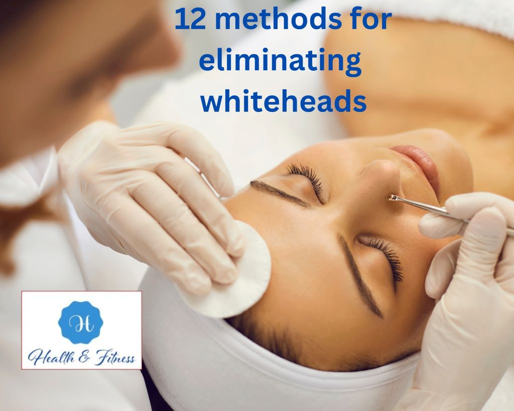 The top 12 methods for eliminating whiteheads