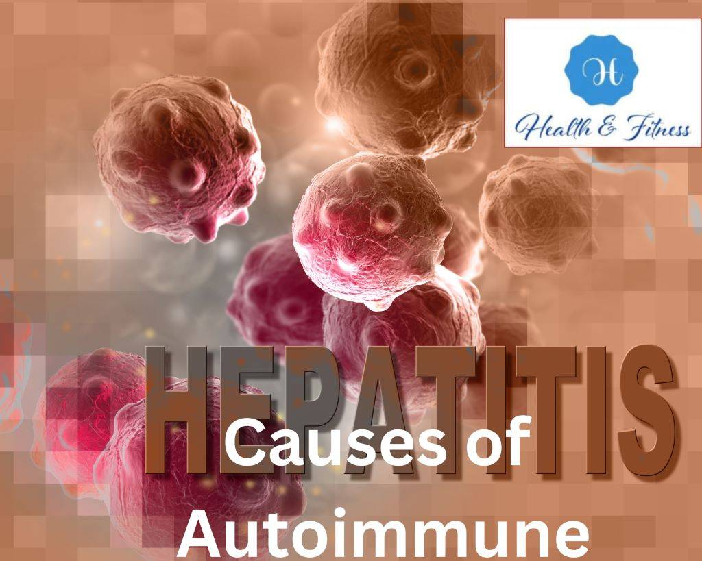 Causes of Autoimmune Hepatitis