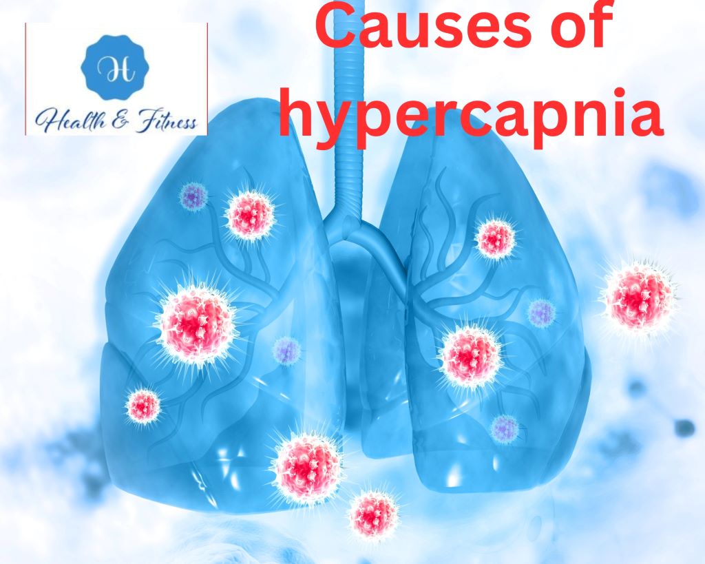 Causes of hypercapnia