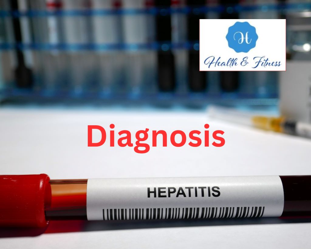 Diagnosis of Hepatitis