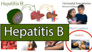 Best 10 treatments and therapies for Hepatitis B