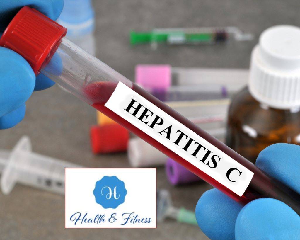 Hepatitis C causes, treatment, and Prevention