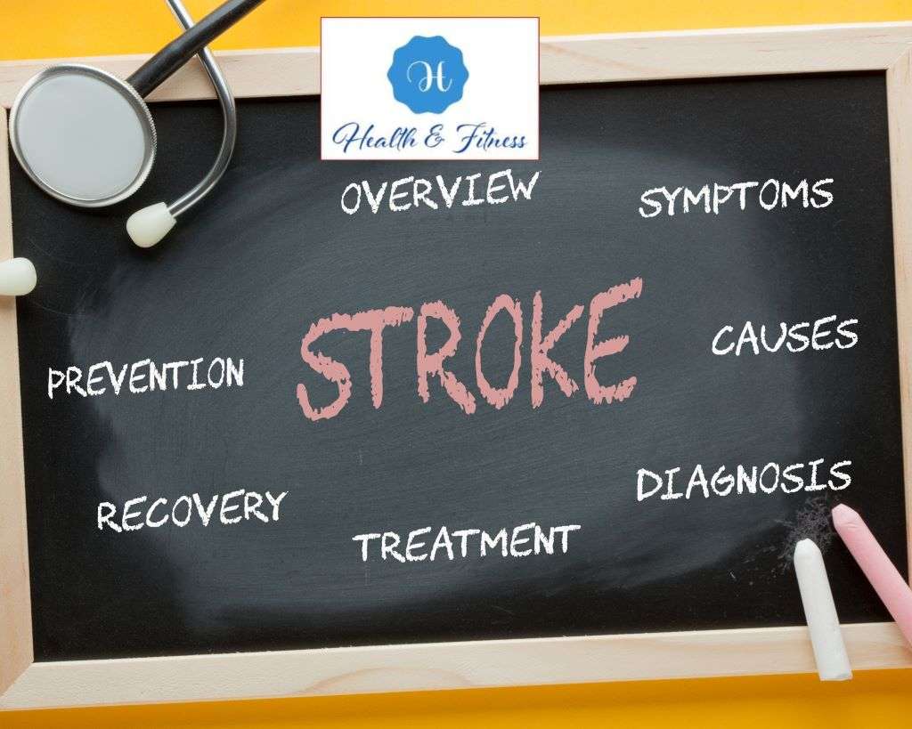 Stroke symptoms NHS