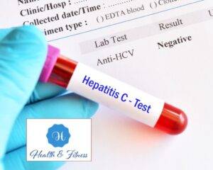 Testing and Diagnosis of Hepatitis C