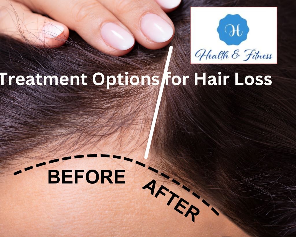 Hair loss causes Remedies