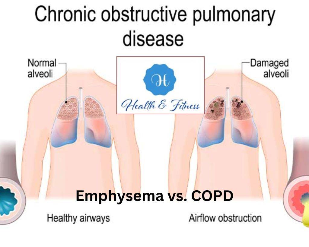 Beyond the Basics Uncovering the Nuances of Emphysema vs. COPD