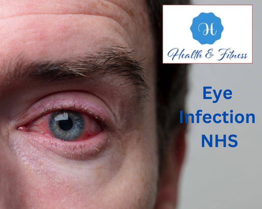 Eye Infection NHSThe Connection Between Seasonal Allergies and Eye Health