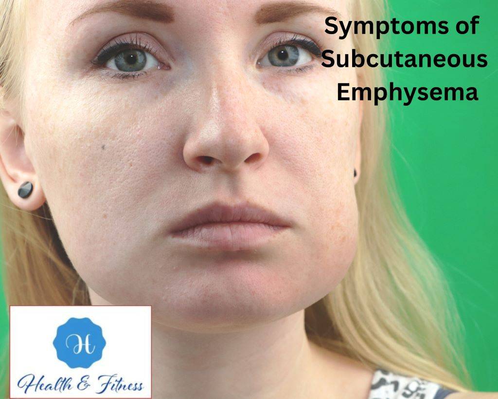 Symptoms of Subcutaneous Emphysema