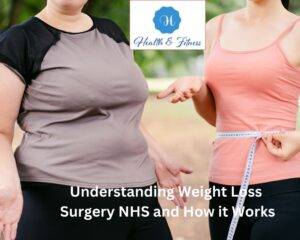 Understanding Weight Loss Surgery NHS and How it Works