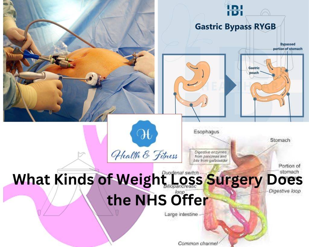 What Kinds of Weight Loss Surgery Does the NHS Offer