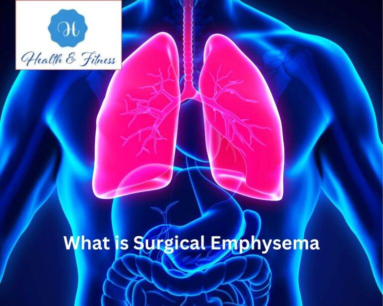 Surgical Emphysema Risks And Complications Associated With Treatment