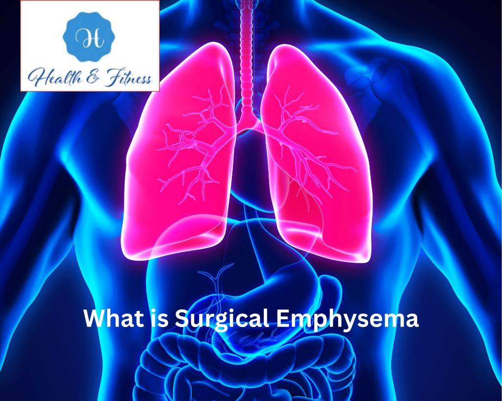 What is Surgical Emphysema