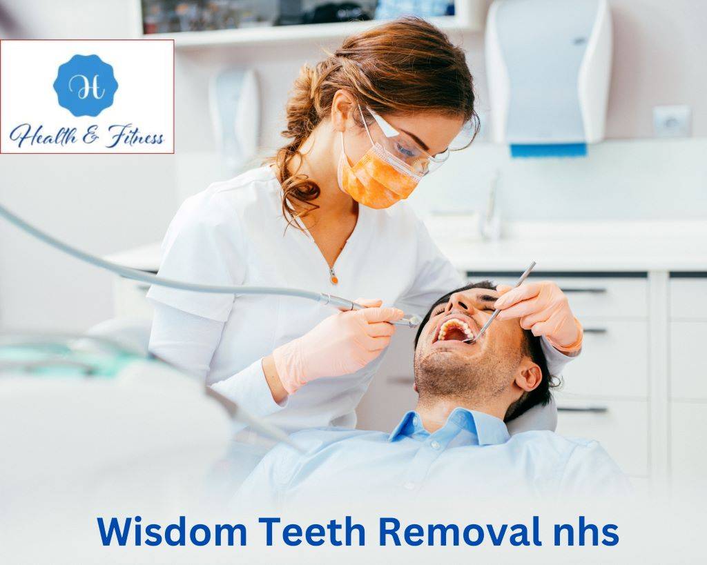 wisdom teeth removal nhs