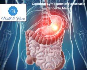 Common Symptoms of Pancreatic Cancer in Males