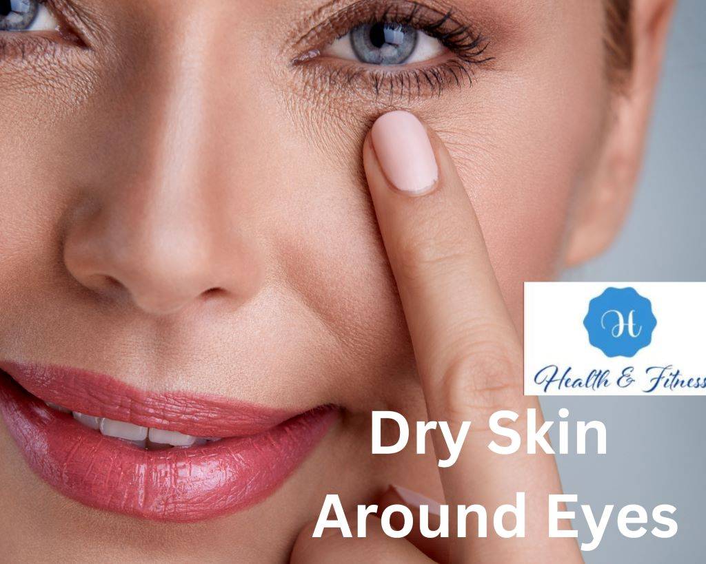 Dry Skin Around Eyes