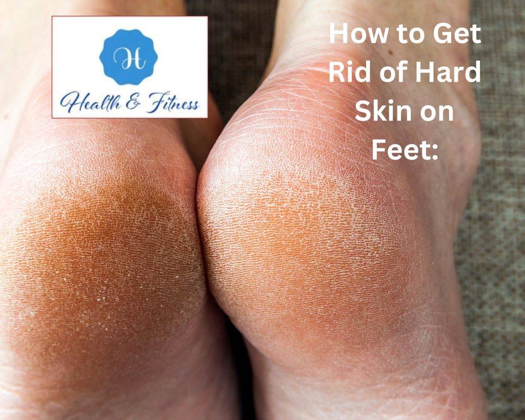 How to Get Rid of Hard Skin on Feet