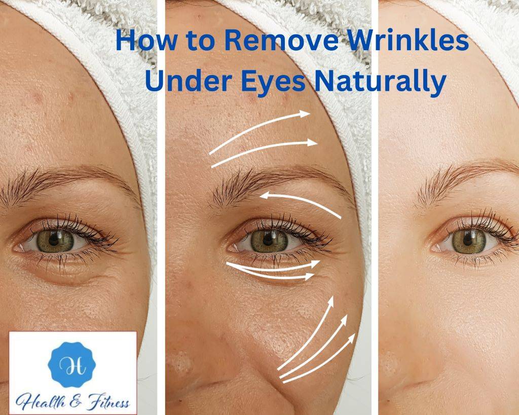 How to Remove Wrinkles Under Eyes Naturally