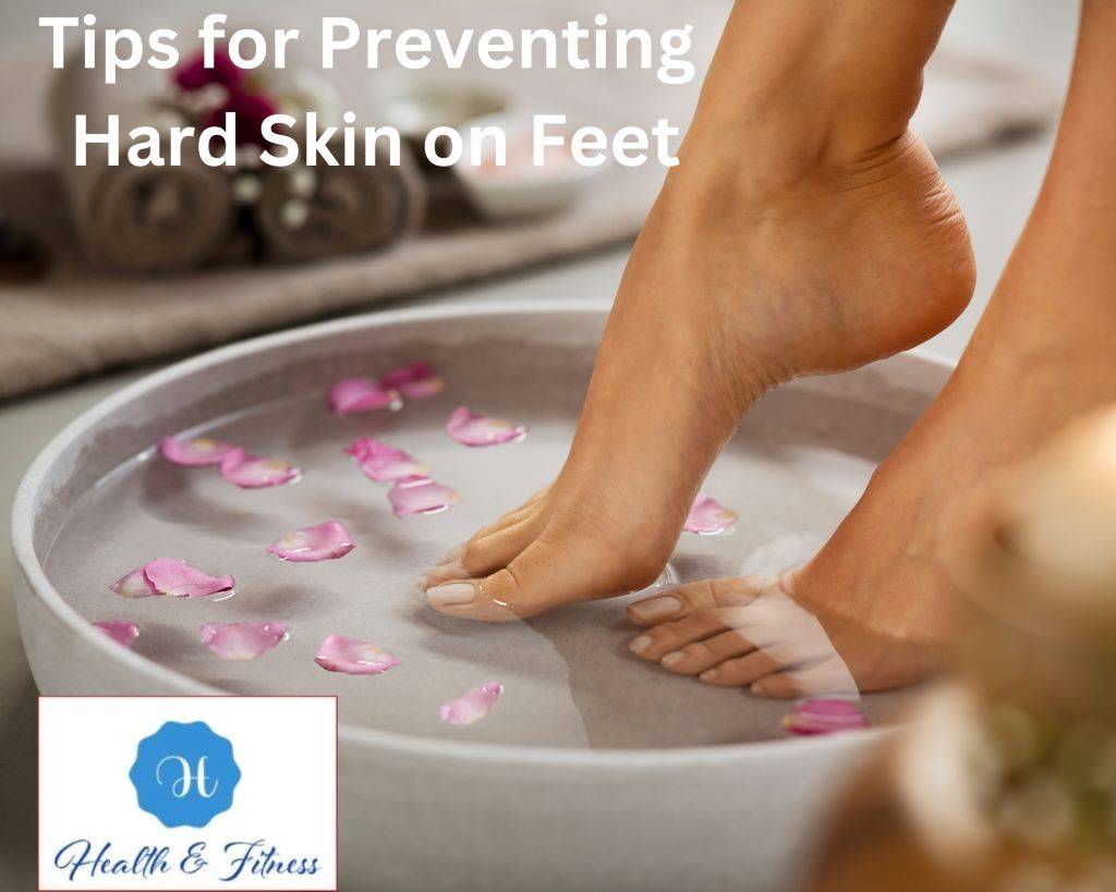 Tips for Preventing Hard Skin on Feet