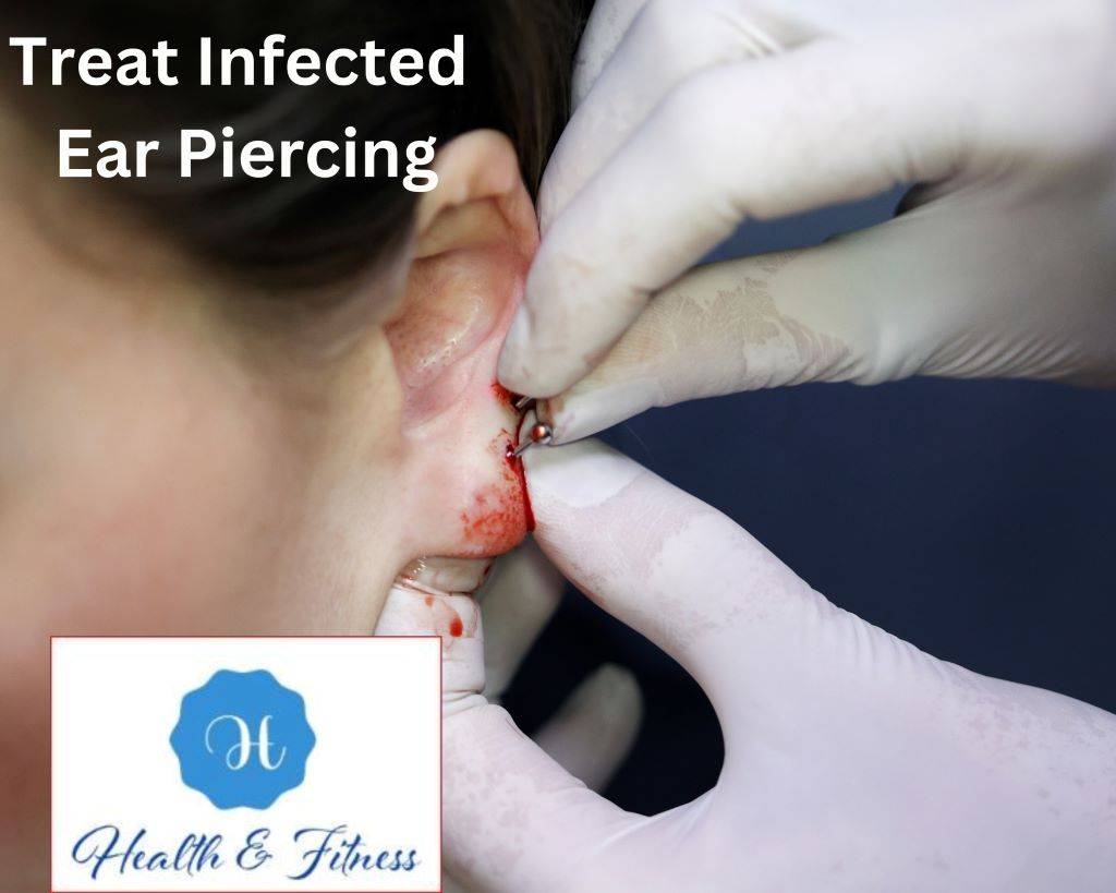 Treat Infected Ear Piercing
