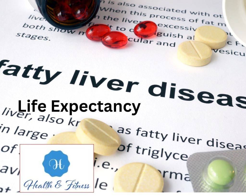 Life Expectancy with Fatty Liver Disease