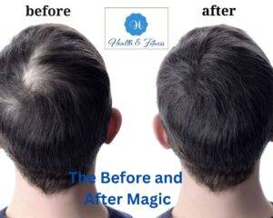 he Before and After Magic