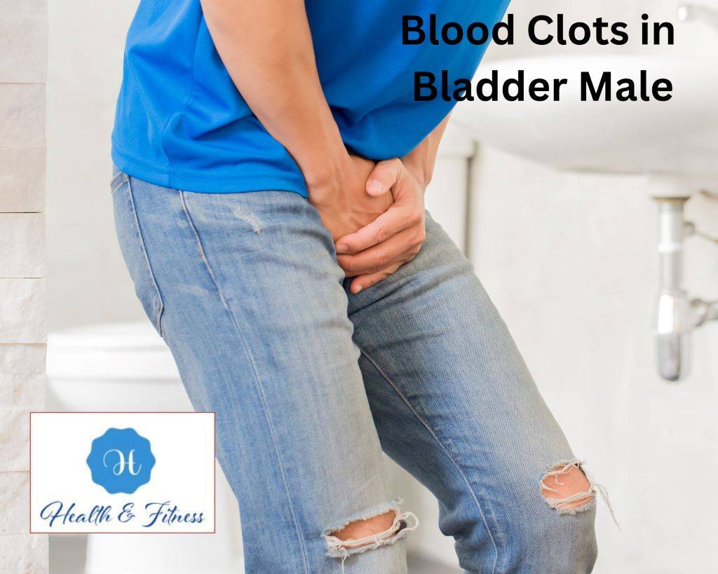 Blood Clots in Bladder Male