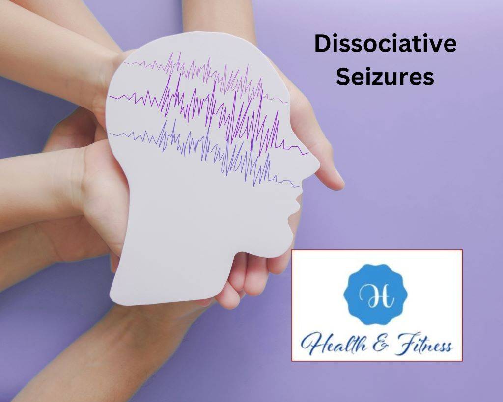 Dissociative Seizures