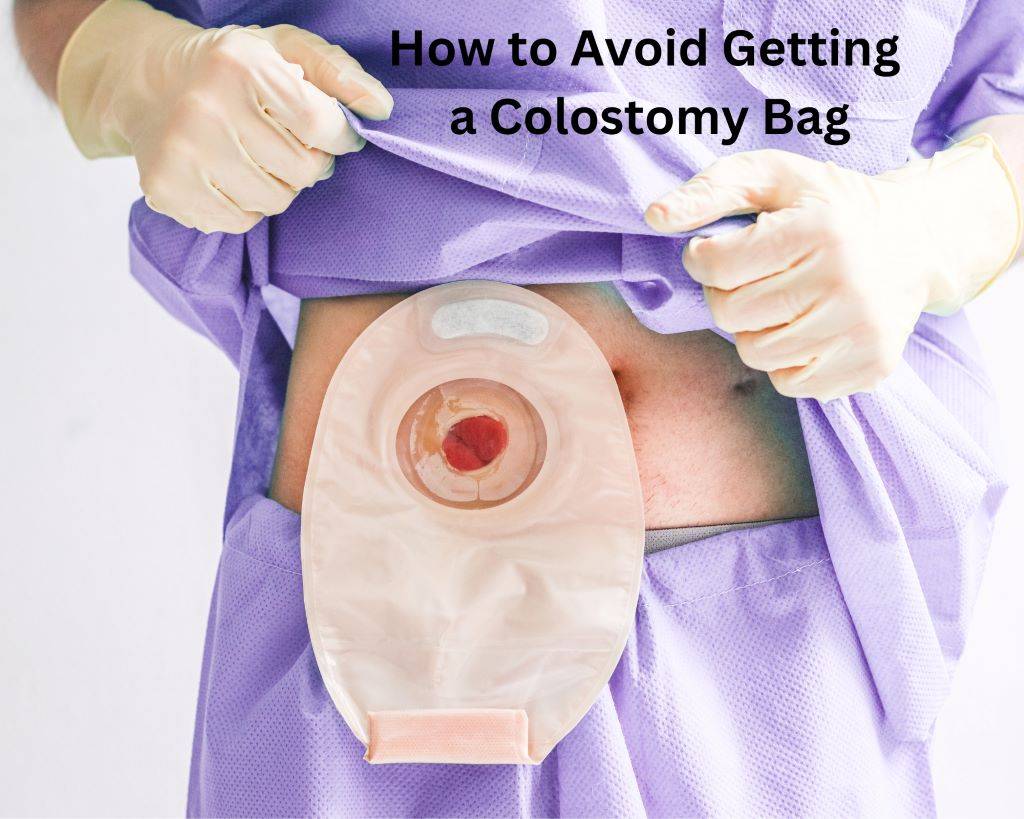 How to Avoid Getting a Colostomy Bag