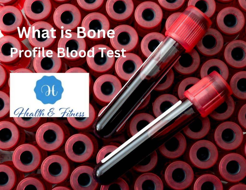 What is Bone Profile Blood Test