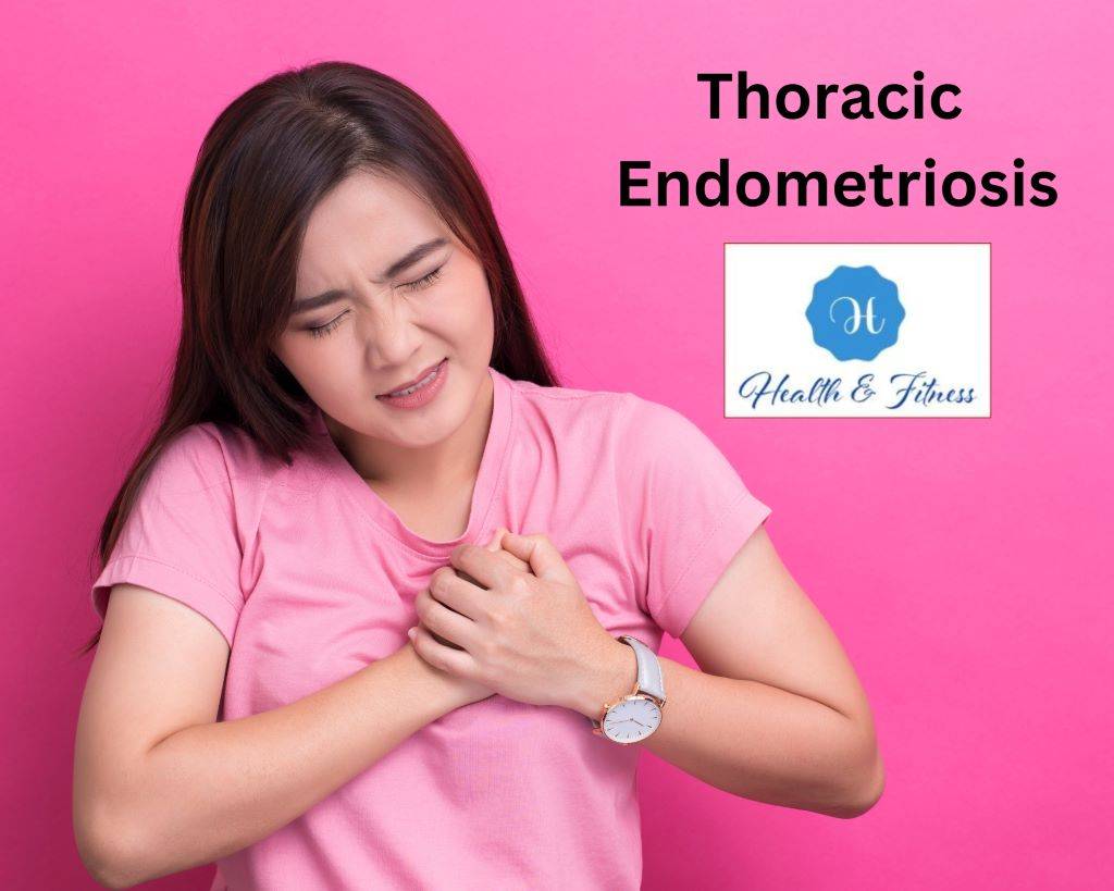 Thoracic Endometriosis