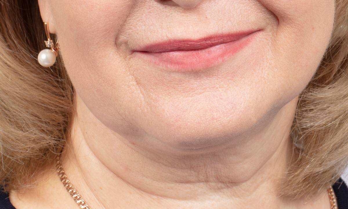 aging neck