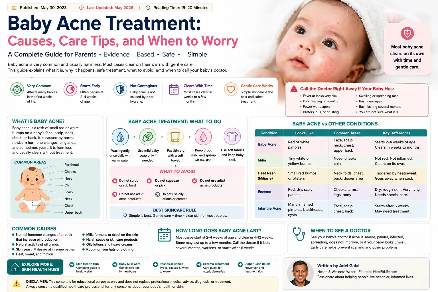 Baby acne treatment - Parent holding a comfortable newborn while a pediatric clinician checks mild baby acne beside a soft washcloth and gentle baby cleanser