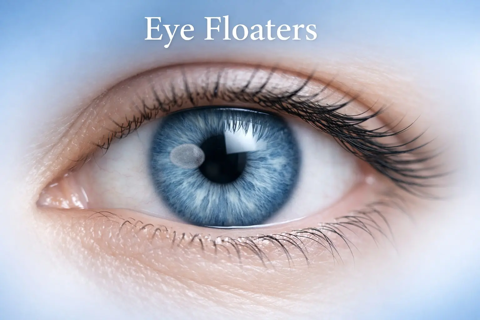 : Eye floaters illustration showing vitreous specks in vision with warning signs for dangerous floaters including retinal detachment symptoms and when to see a doctor